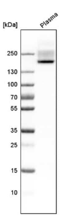 Complement Factor H Antibody, Novus Biologicals 0.1mL; Unlabeled:Antibodies,